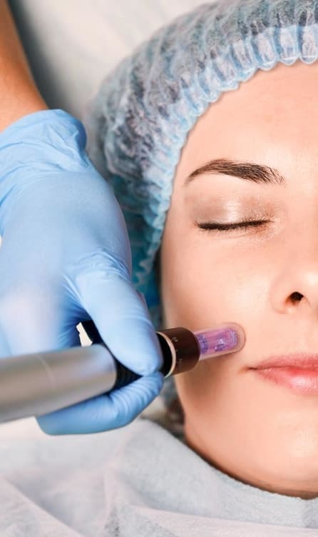 Takroni Clinic - Medical Microneedling